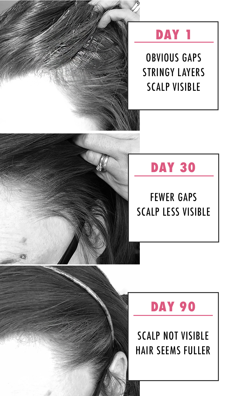 I Tried Nioxin Hair Regrowth Treatment For 90 Days Momskoop