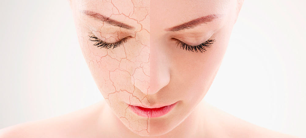 Foundations For Dry Skin