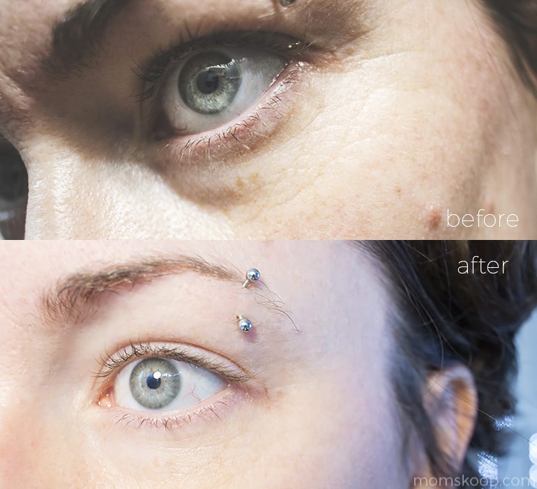 SkinPro BIO-Placenta Revitalizing Serum before and after