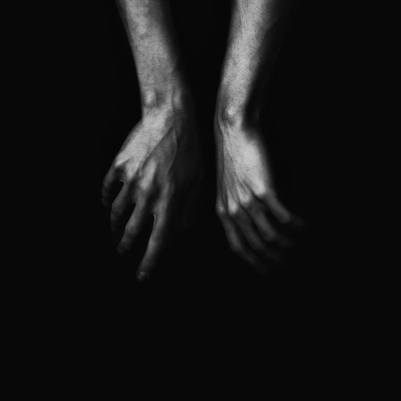 Unkempt Nails and Hands