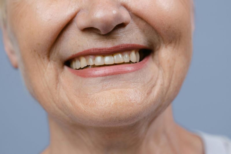 Yellowing Teeth