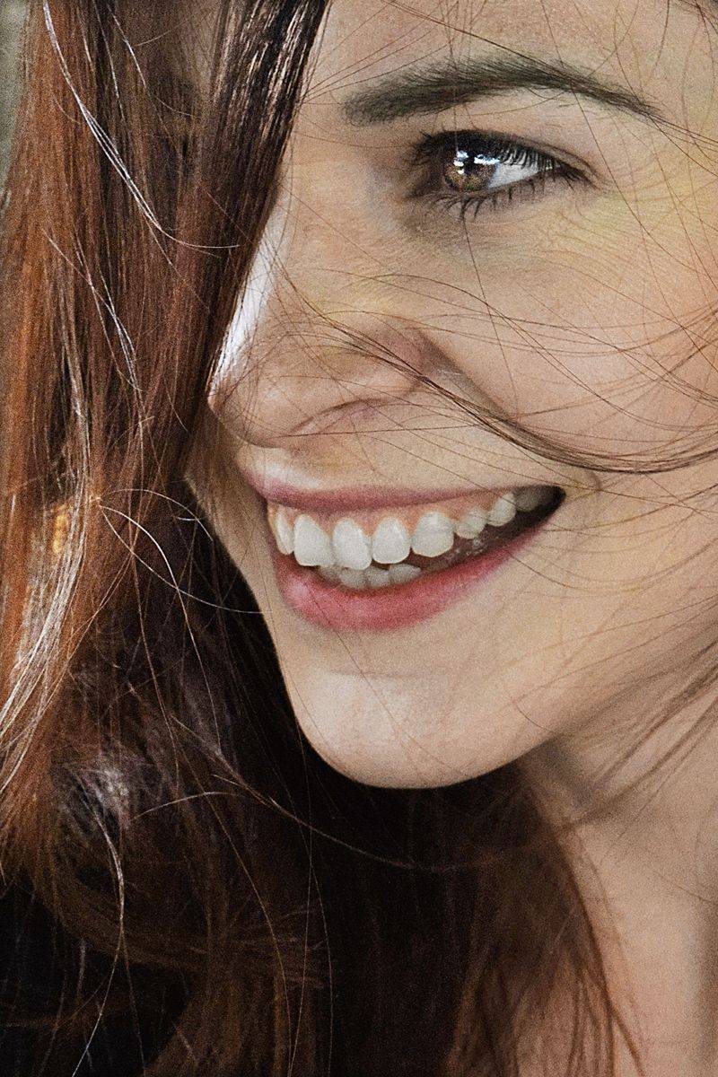 Smile Imperfections