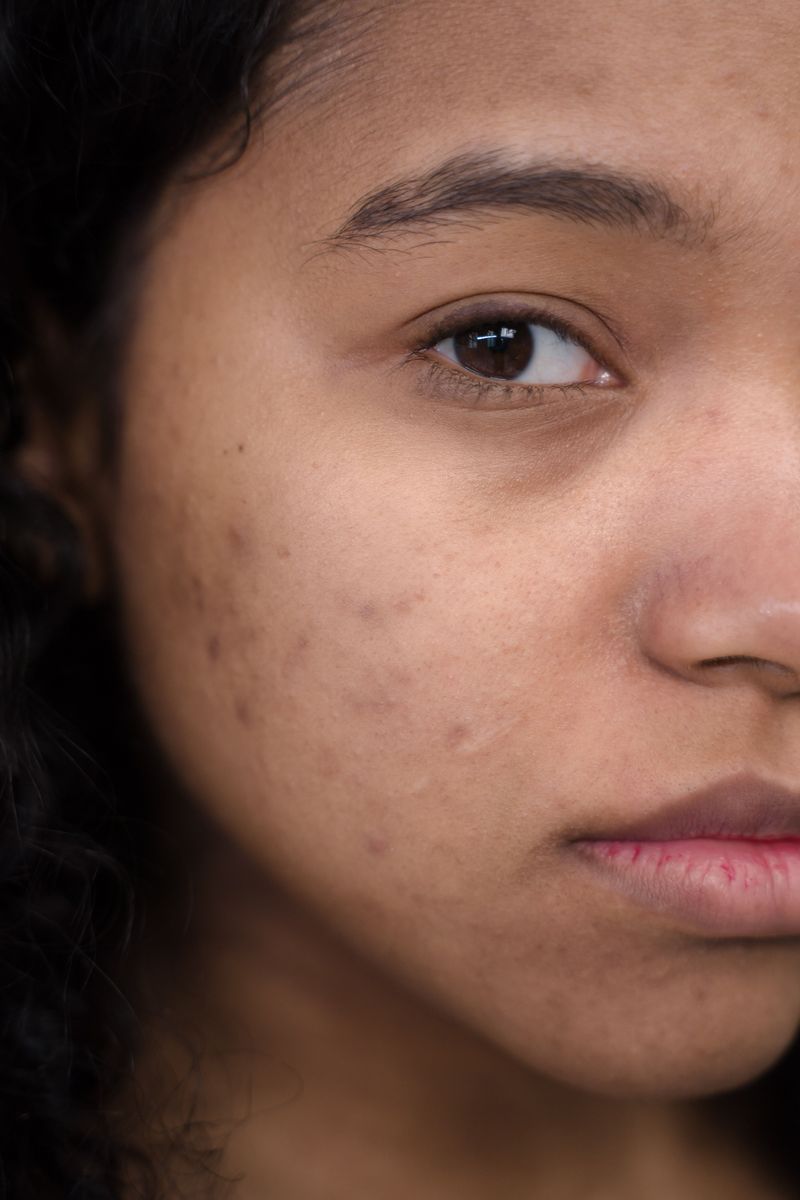 Tiny Skin Imperfections