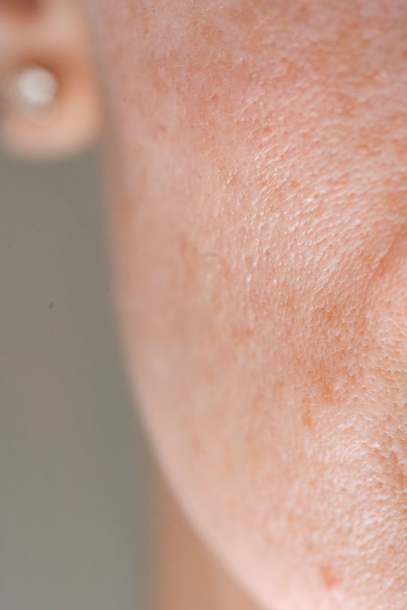 Visible Pores