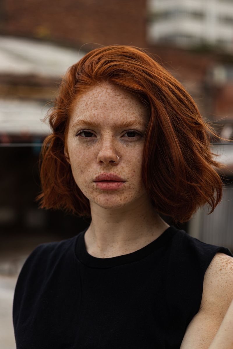 Freckles or Beauty Marks