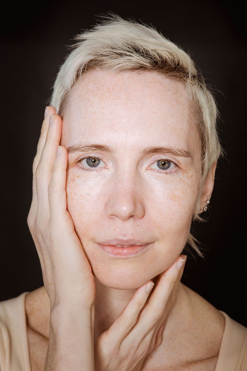 Dull-Looking Complexion