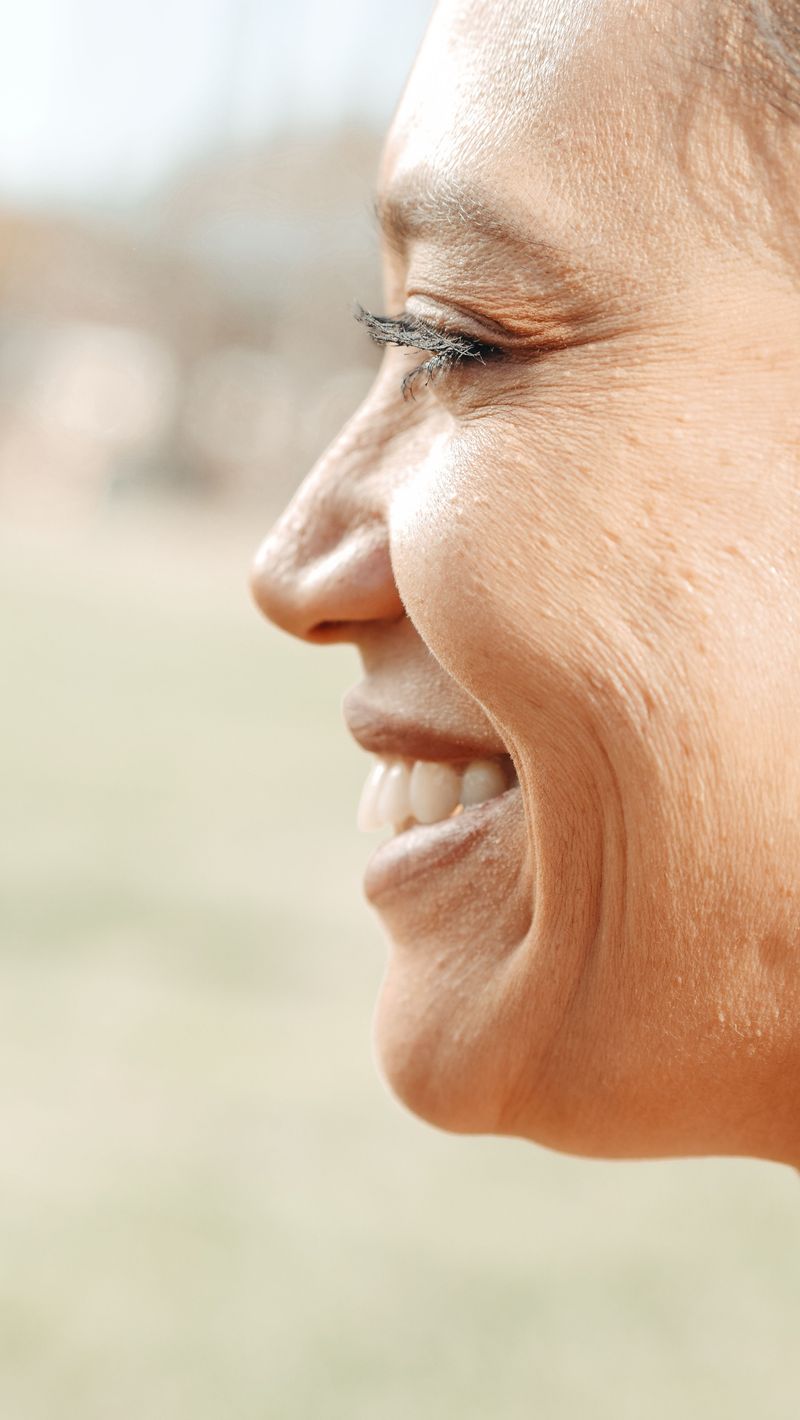 Smile Lines and Crow's Feet